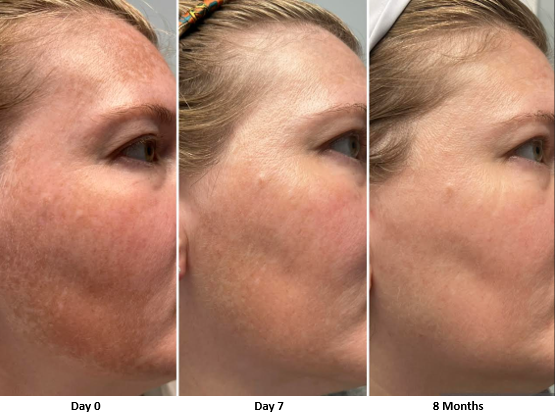 Vibrant C Serum - Image 3
